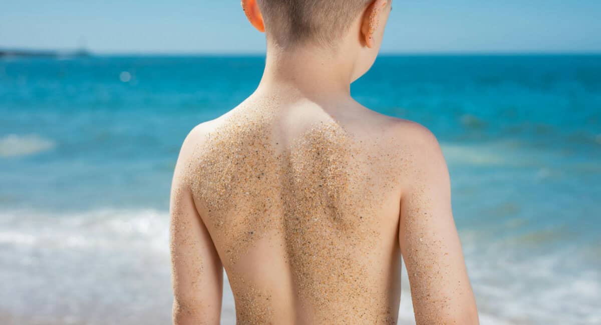 How to Care for Your Child's Sunburn